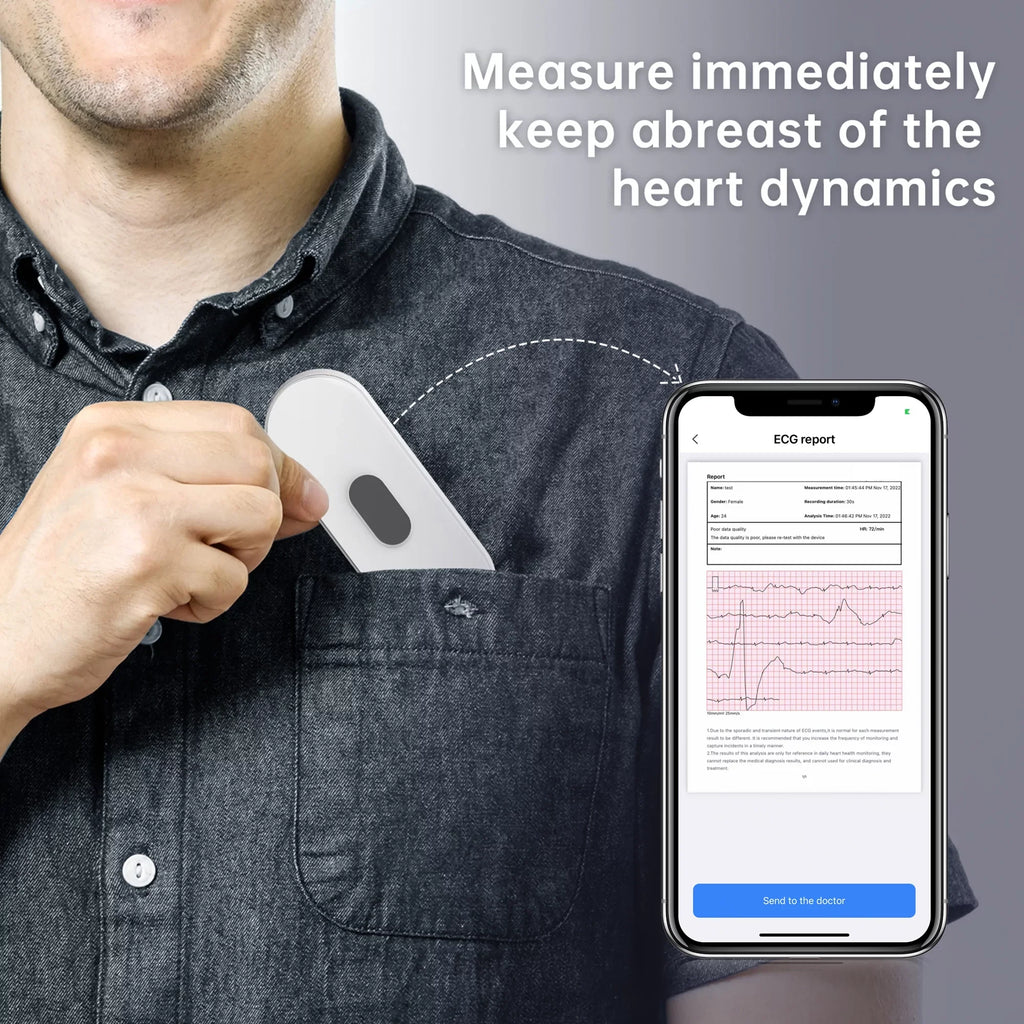 Wellue ECG Heart Monitor with Screen Display,Handheld Bluetooth Personal EKG Monitor with Heart Rate Tracker for Home Use,30s-5mins Measurement,Unlimited Storage Free APP